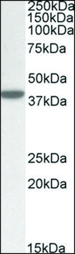 Anti-ERLIN1 (C-terminal) antibody produced in goat affinity isolated antibody, buffered aqueous solution