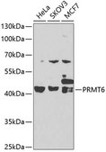 Anti- PRMT6 antibody produced in rabbit