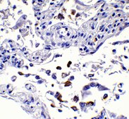 Anti-SARS-CoV-2 (COVID-19) Spike S1 antibody produced in rabbit affinity isolated antibody