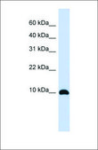 Anti-ID1 antibody produced in rabbit affinity isolated antibody