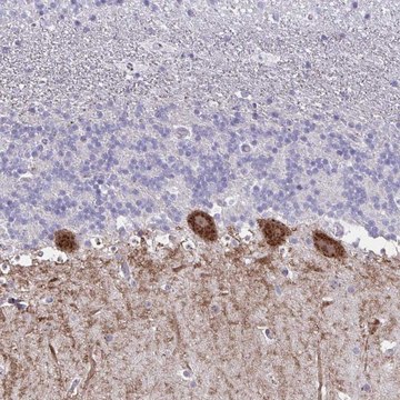 Anti-GALNT16 antibody produced in rabbit Prestige Antibodies&#174; Powered by Atlas Antibodies, affinity isolated antibody, buffered aqueous glycerol solution