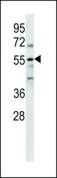 ANTI-PARP2 (N-TERM) antibody produced in rabbit IgG fraction of antiserum, buffered aqueous solution