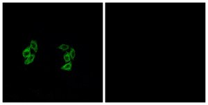Anti-CKI-α1 antibody produced in rabbit affinity isolated antibody