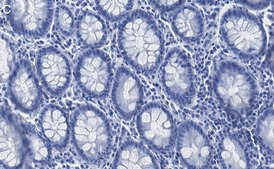 Anti-FOXO3A Antibody, clone 1G18 ZooMAb® Rabbit Monoclonal recombinant, expressed in HEK 293 cells