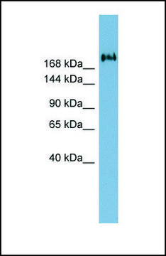 Anti-TMEM2 antibody produced in rabbit affinity isolated antibody