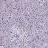 Anti-PLCB1 antibody produced in rabbit Prestige Antibodies® Powered by Atlas Antibodies, affinity isolated antibody, buffered aqueous glycerol solution
