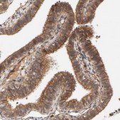 Anti-TYK2 antibody produced in rabbit Prestige Antibodies® Powered by Atlas Antibodies, affinity isolated antibody, buffered aqueous glycerol solution