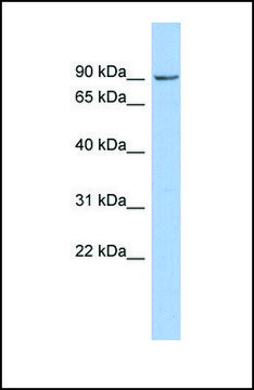 抗-NPHP1 兔抗 affinity isolated antibody