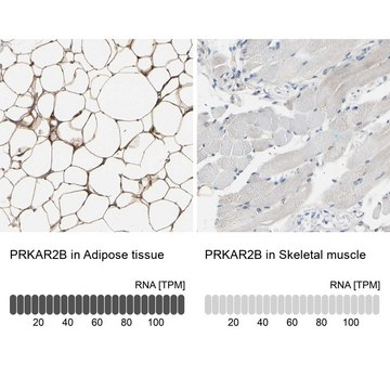 Anti-PRKAR2B antibody produced in rabbit Prestige Antibodies&#174; Powered by Atlas Antibodies, affinity isolated antibody, buffered aqueous glycerol solution