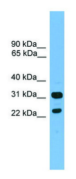 Anti-CD8B antibody produced in rabbit affinity isolated antibody