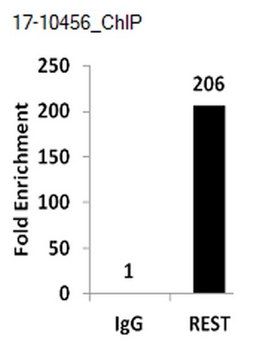 ChIPAb+ REST - ChIP Validated Antibody and Primer Set from rabbit