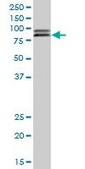 Anti-CBFA2T2 antibody produced in mouse IgG fraction of antiserum, buffered aqueous solution