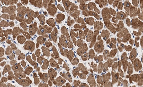 Anti-Phospholamban Antibody, clone 4J16 , ZooMAb&#174; Rabbit Monoclonal recombinant, expressed in HEK 293 cells