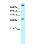 Anti-TST antibody produced in rabbit affinity isolated antibody