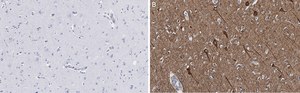 Anti-Neurofilament H Antibody, clone 5L10, ZooMAb® Rabbit Monoclonal recombinant, expressed in HEK 293 cells