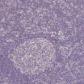 Anti-JPH2 antibody produced in rabbit Prestige Antibodies® Powered by Atlas Antibodies, affinity isolated antibody, buffered aqueous glycerol solution