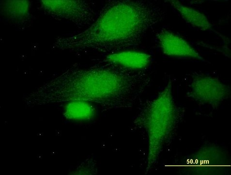 Monoclonal Anti-ATE1 antibody produced in mouse clone 2B6, purified immunoglobulin, buffered aqueous solution