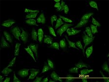 Monoclonal Anti-RPL19 antibody produced in mouse clone 3H4, purified immunoglobulin, buffered aqueous solution
