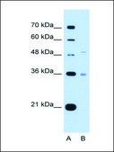 Anti-UST antibody produced in rabbit IgG fraction of antiserum