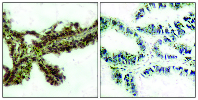 Anti-phospho-AKT1 (pThr308) antibody produced in rabbit affinity isolated antibody