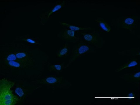 Anti-IFIT2 antibody produced in mouse purified immunoglobulin, buffered aqueous solution