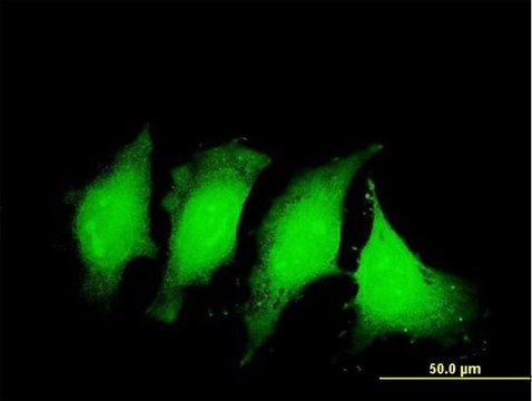 Monoclonal Anti-IL1B antibody produced in mouse clone 2A8, purified immunoglobulin, buffered aqueous solution