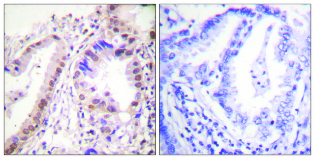 Anti-Estrogen Receptor-&#945;, C-Terminal antibody produced in rabbit affinity isolated antibody