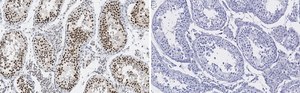 Anti-HDAC2 Antibody, clone 1E22 ZooMAb® Rabbit Monoclonal recombinant, expressed in HEK 293 cells