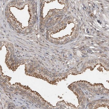 Anti-ABL1 antibody produced in rabbit Prestige Antibodies&#174; Powered by Atlas Antibodies, affinity isolated antibody, buffered aqueous glycerol solution, Ab2