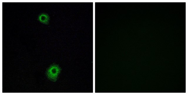 抗-HTR1B 兔抗 affinity isolated antibody