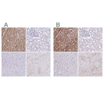 Anti-TNNT2 antibody produced in rabbit Prestige Antibodies&#174; Powered by Atlas Antibodies, affinity isolated antibody, buffered aqueous glycerol solution