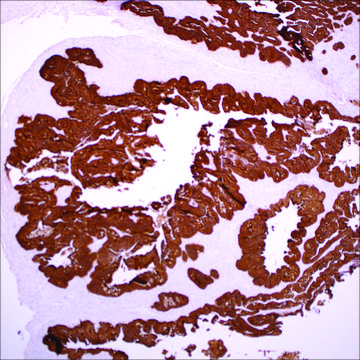 Villin (EP163) Rabbit Monoclonal Primary Antibody