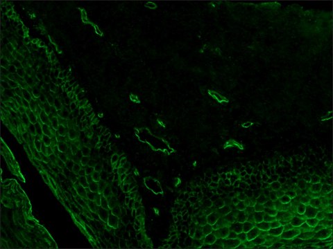 Anti-Lectin, Ulex europaeus-I antibody produced in rabbit whole antiserum, delipidized