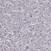 Anti-TOE1 antibody produced in rabbit Prestige Antibodies® Powered by Atlas Antibodies, affinity isolated antibody, buffered aqueous glycerol solution