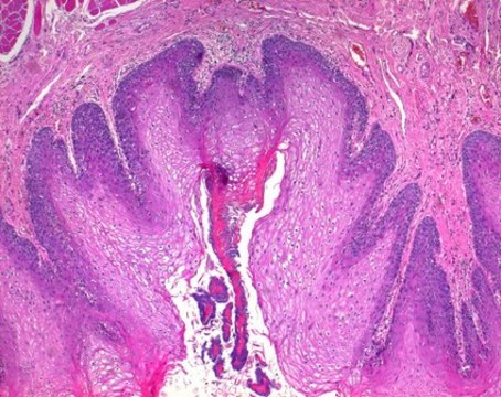 Phloxin B (C.I. 45410) for microscopy Certistain&#174;