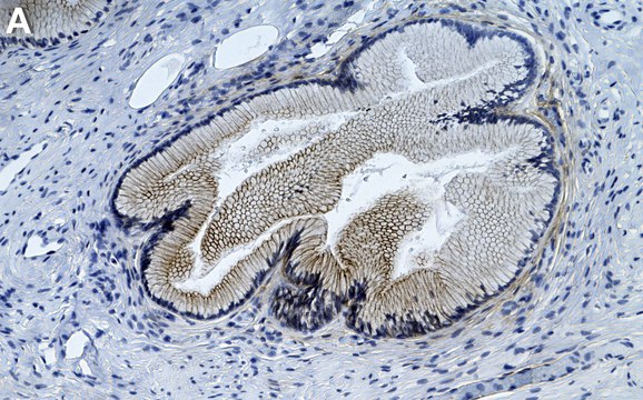 Anti-Phospho-EGFR (Tyr1068) Antibody, clone 3F4 ZooMAb&#174; Rabbit Monoclonal recombinant, expressed in HEK 293 cells