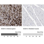 Anti-SGSH antibody produced in rabbit Prestige Antibodies® Powered by Atlas Antibodies, affinity isolated antibody, buffered aqueous glycerol solution, Ab1
