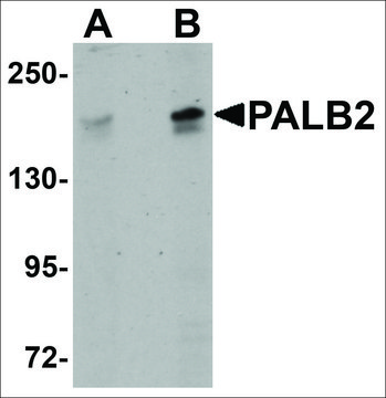 Anti-PALB2 antibody produced in rabbit affinity isolated antibody, buffered aqueous solution