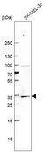 Anti-BRMS1 antibody produced in rabbit Prestige Antibodies® Powered by Atlas Antibodies, affinity isolated antibody, buffered aqueous glycerol solution