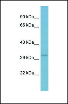 Anti-TNFSF13B, (N-terminal) antibody produced in rabbit affinity isolated antibody