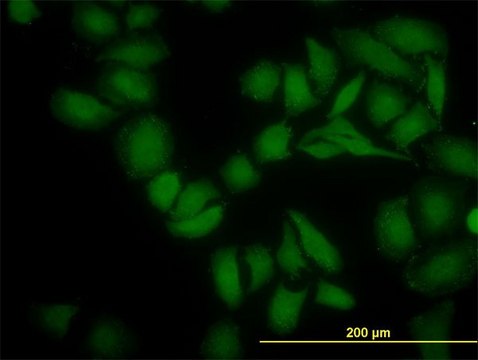 Monoclonal Anti-SGK2 antibody produced in mouse clone 4G4, purified immunoglobulin, buffered aqueous solution