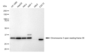 KD-Validated Anti Chromosome 3 open reading frame 38 Antibody, clone 23GB1150, Rabbit Monoclonal clone 23GB1150, recombinant rabbit monoclonal, expressed in HEK293 cells