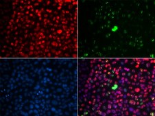 Anti-Phospho-ATM-S1981 antibody produced in rabbit