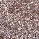 Anti-EXOC6 antibody produced in rabbit Prestige Antibodies® Powered by Atlas Antibodies, affinity isolated antibody, buffered aqueous glycerol solution