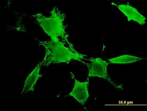 Monoclonal Anti-PAK3 antibody produced in mouse clone 3A12, purified immunoglobulin, buffered aqueous solution