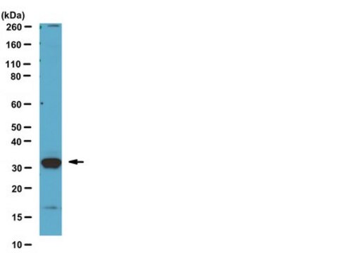 Anti-Kallikrein-3 (KLK3) (CT) Antibody from rabbit