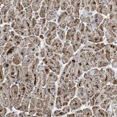 Anti-ETFB antibody produced in rabbit Prestige Antibodies® Powered by Atlas Antibodies, affinity isolated antibody, buffered aqueous glycerol solution, Ab1
