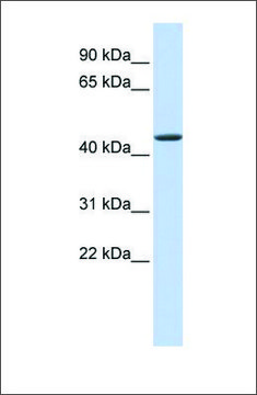 Anti-JMJD4 antibody produced in rabbit affinity isolated antibody