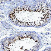Anti-IL4I1 antibody produced in rabbit Prestige Antibodies® Powered by Atlas Antibodies, affinity isolated antibody, buffered aqueous glycerol solution