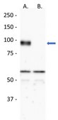 Anti-RHBDF2 Antibody, clone RHF2B 11H7